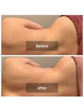 メディカル整体院/美背中＆くびれお作りします！