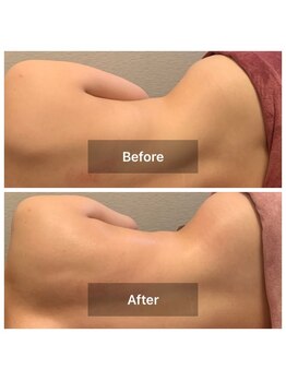 メディカル整体院/美背中＆くびれお作りします！