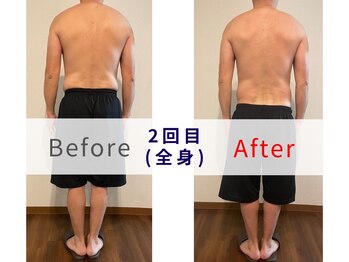 シャルマン(CHARMANT)/速攻オーダーメイド痩身