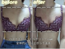 スノードロップ(snowdrop)/バストアップ　１回での変化