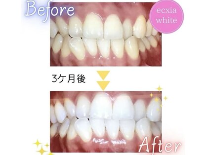 エクシアホワイトニング 東上野店の写真