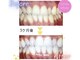 エクシアホワイトニング 東上野店の写真