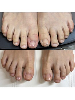 リリ(lili)/トータルフットケア1回目