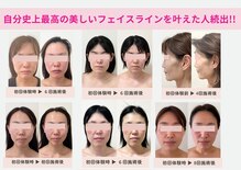 ラヴィ(Lavie)