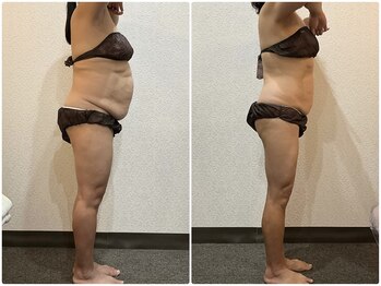 ウェリナ平和堂長久手院/小顔矯正/骨盤矯正/美脚サロン