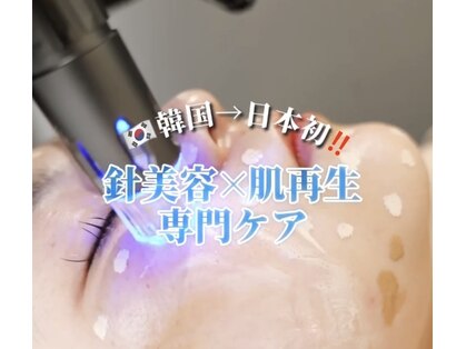 リノ(Lino)の写真