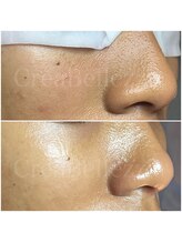 クレアベレッツァ(Crea Bellezza)/理想の肌へ♪