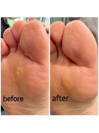 角質ケアが人気☆