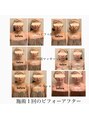 ララ(LALA) 結果重視の顔筋マッサージ☆小顔になりたい方もお任せ下さい♪♪
