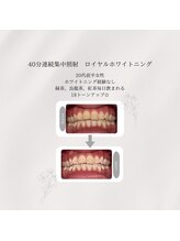 プラスビーセルフ(+b self)/ホワイトニングビフォーアフター