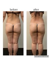 ソリス ビューティー(SOLIS BEAUTY)/充実痩身