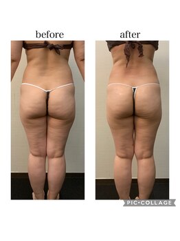 ソリス ビューティー(SOLIS BEAUTY)/充実痩身