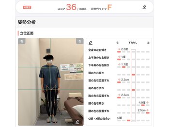 かがりの整骨院 東近江八日市院/4.AI活用した姿勢の評価
