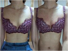 スノードロップ(snowdrop)/バストアップ　１回での変化