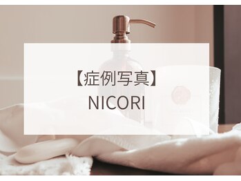 ニコリ 大宮(NICORI)/NICORI症例写真