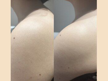 リタ 銀座(Rita)/シェービング