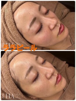 ナチュール(NaTuRu)/韓国肌管理【ララピール】水光肌