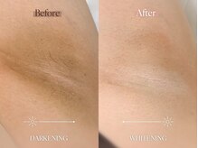 エメ(aimer)/LEMELLA《メラニンケア》