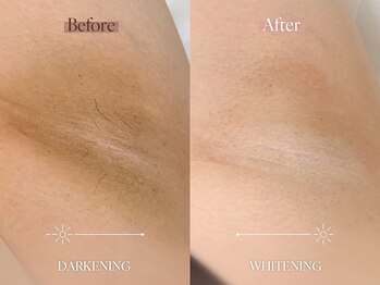 エメ(aimer)/LEMELLA《メラニンケア》