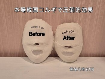 薬手名家 心斎橋店/お客様ビフォーアフター