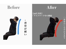 リスタート腰痛整体院 舟入院/施術例：20代男性　腰痛