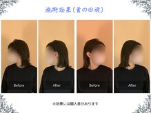 ボディ リセット アンド デザイン(Body Reset & Design)/【施術例】ビフォーアフター