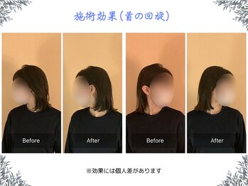 ボディ リセット アンド デザイン(Body Reset & Design)/【施術例】ビフォーアフター