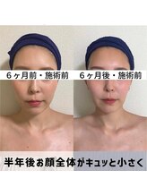 お顔の研究所/ビフォーアフター写真♪