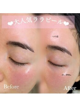 サニーラッシュ &nbsp;高蔵寺 志段味店(Sunny Lash)/ (ララピール)初回価格 6,500円