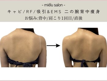 ミエル(mielu)/ブライダル 二の腕/背中