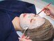 セローナ(Selona)の写真/【美肌の新常識】ララピールで輝く透明感を手に入れよう。ララピールでシミ改善・くすみを徹底ケア◎