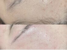 ラニブロウ(Lani brow)/産毛も角質も一掃！