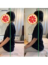 グレフル鍼灸接骨院 整体院 心斎橋/整体/肩こり/マッサージ/腰痛