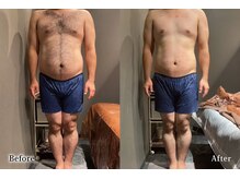 アネル オム 新都心店(ANEL HOMME)/