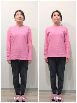 いとう美容整体/☆立ち姿勢正面のBefore After☆