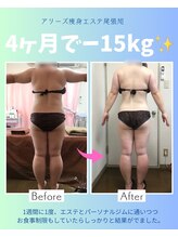 アリーズ エステ スウェイ(ally's esthe sway)/before,after