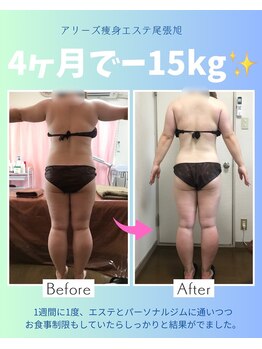 アリーズ エステ スウェイ(ally's esthe sway)/before,after