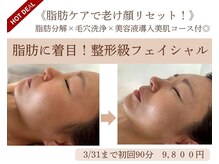 エルブラン(Herb ame)