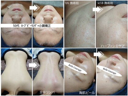 ベルクラージュ(Belle Courage)の写真