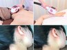 エステ以上【美療全身脱毛＋美療VIO脱毛】脱毛効果＆美肌の実績で年間1,000名