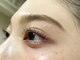 ベリスラッシュ(Bellis Lash)の写真/【次世代まつ毛パーマ・ラッシュリフト】で、なりたい目元を叶える◎落ち着いた空間での施術♪