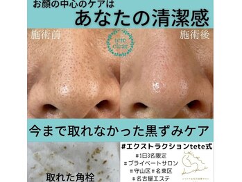 キキ(kiki)/唯一の無添加エクストラクション