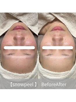 インク(ink)/【赤み軽減/トーンアップ】