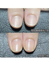 ギフト(GIFT)/自爪育成ネイルケア