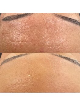 リリット/エアバリの変化