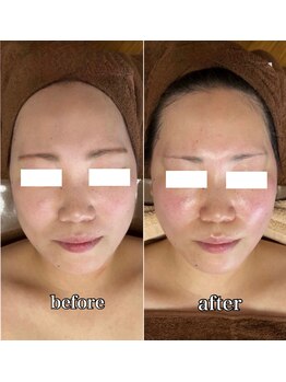 ロジュマンアンドクレア(LOGEMENT&Crea.)/コルギ