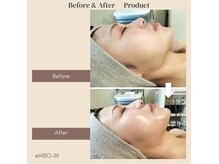 ヒロイントータル(HIRO-IN Tatal)