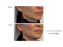 サロンラグナ(Salon Laguna)/Face お客様感想 40代女性