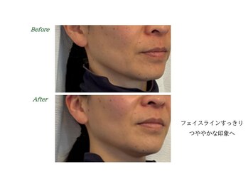 サロンラグナ(Salon Laguna)/Face お客様感想 40代女性