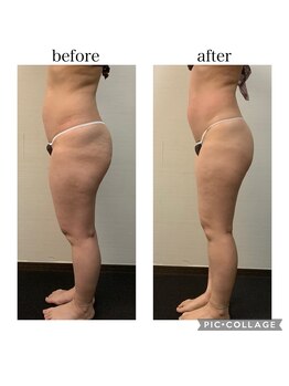 ソリス ビューティー(SOLIS BEAUTY)/充実痩身